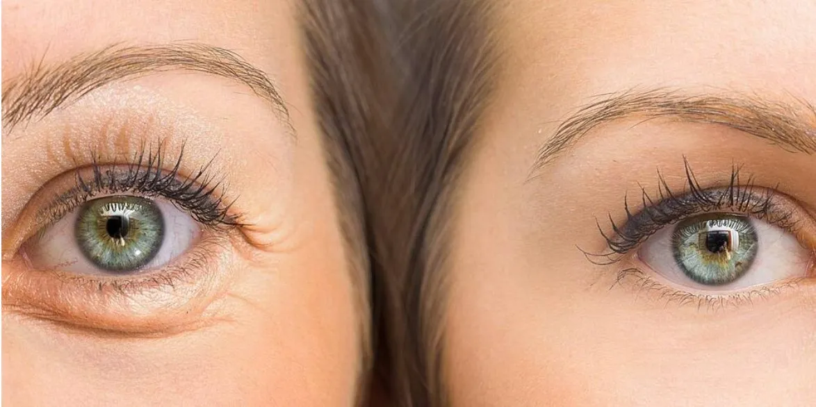 [Sigh Energy] Восстановление кожи глаз | Eyes skin restoration Powerful Plus +11x(Extra Strong)