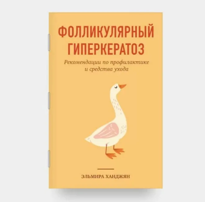 Фолликулярный гиперкератоз (Эльмира Ханджян)