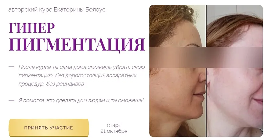 Гиперпигментация. Тариф Единый (Екатерина Белоус)