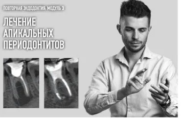 Повторная эндодонтия. Модуль 3: Лечение апикальных периодонтитов (Дмитрий Николаев)