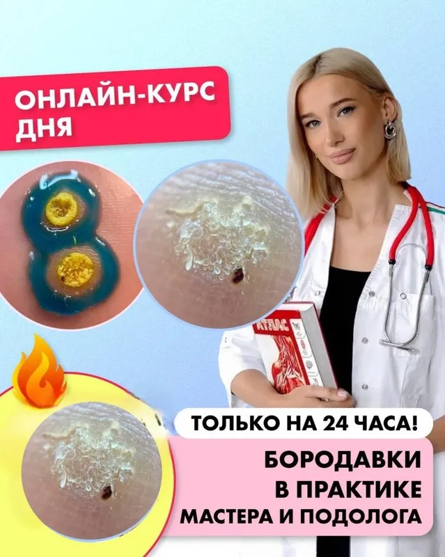 [ParisNail School] Бородавки в практике мастера и подолога (Ангелина Нышонкова)