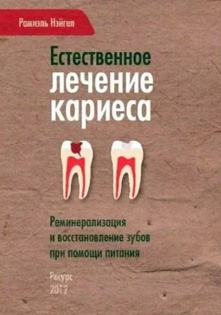 Естественное лечение кариеса (Рамиэль Нэйгел)
