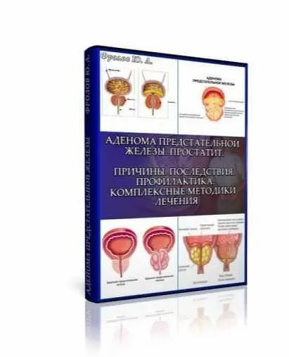 Аденома предстательной железы. Простатит. Мини Инфопродукт №4 (Юрий Фролов)