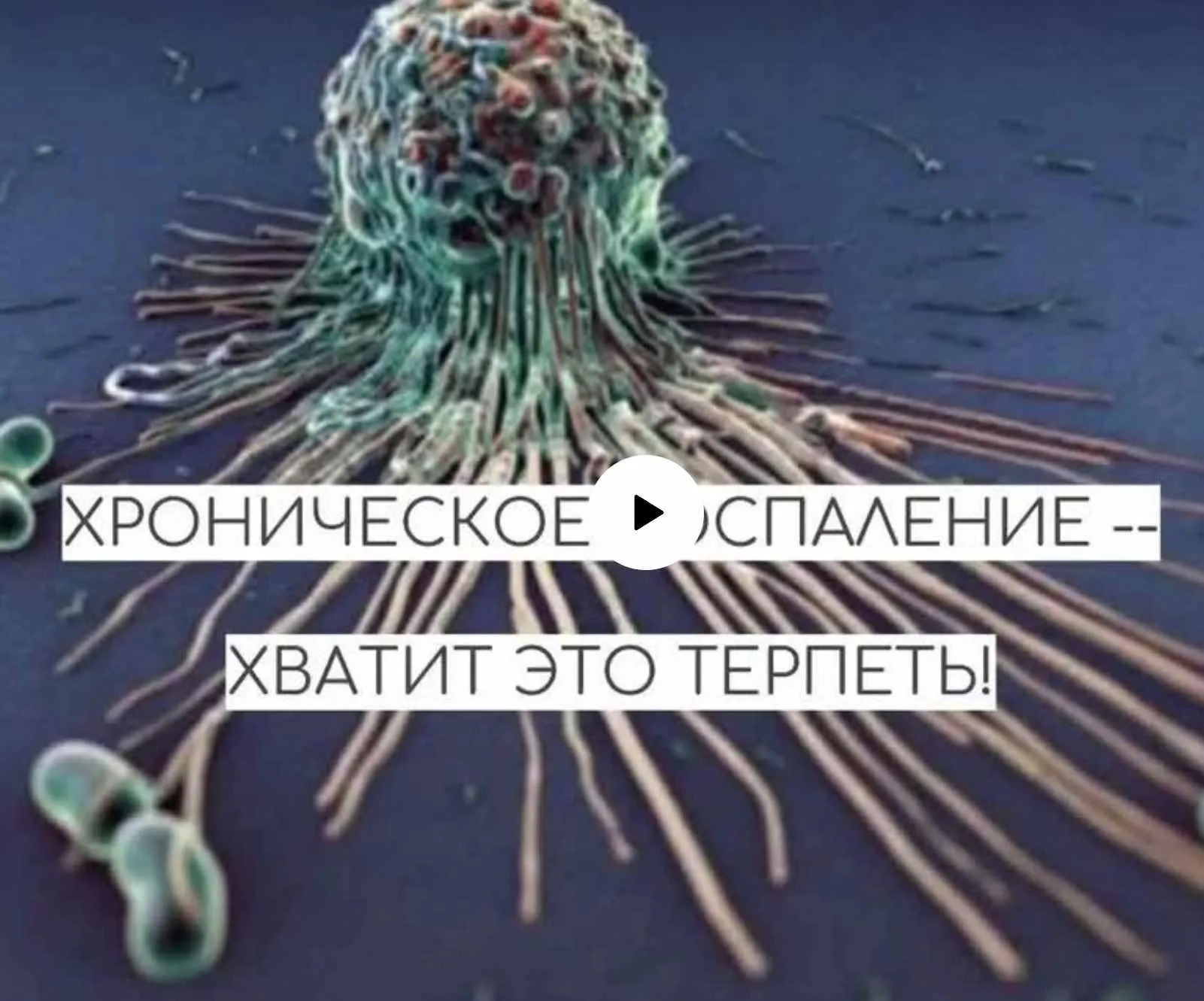 Хроническое воспаление - хватит это терпеть (Оля Буракова)