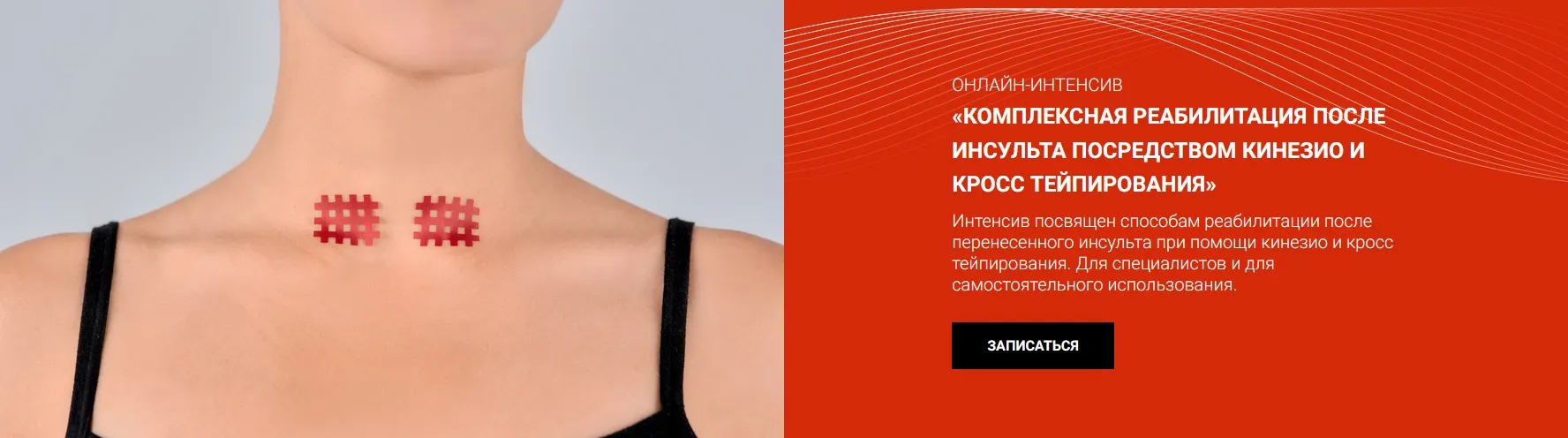 [BBalance] Комплексная реабилитация после инсульта посредством кинезио и кросстейпирования (Валентин Гайт)