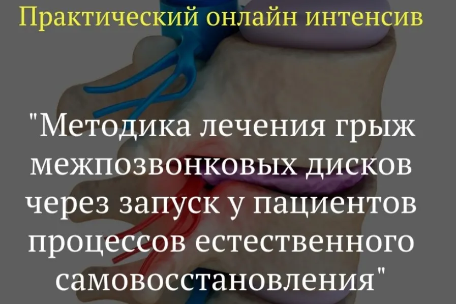 Методика лечения грыж межпозвонковых дисков  (Игорь Атрощенко)
