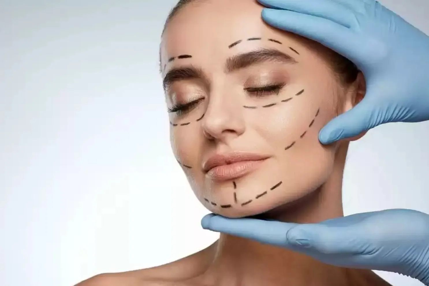 [Akkord] Ботулинотерапия Full-Face (Елена Разумовская)