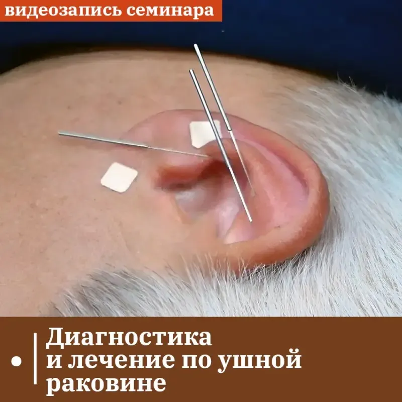 Диагностика и лечение по ушной раковине. Лечение зависимостей (Владимир Кононов)