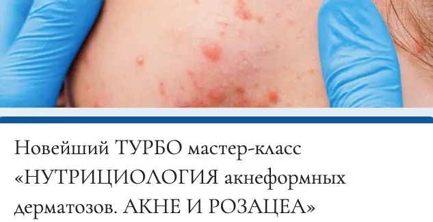 [mokosmed] Нутрициология акнеформных дерматозов. Акне и розацея (Мария Моргунова)