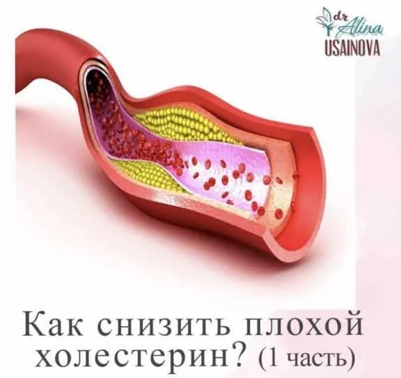 Как снизить плохой холестерин? 1 часть (Алина Усаинова)