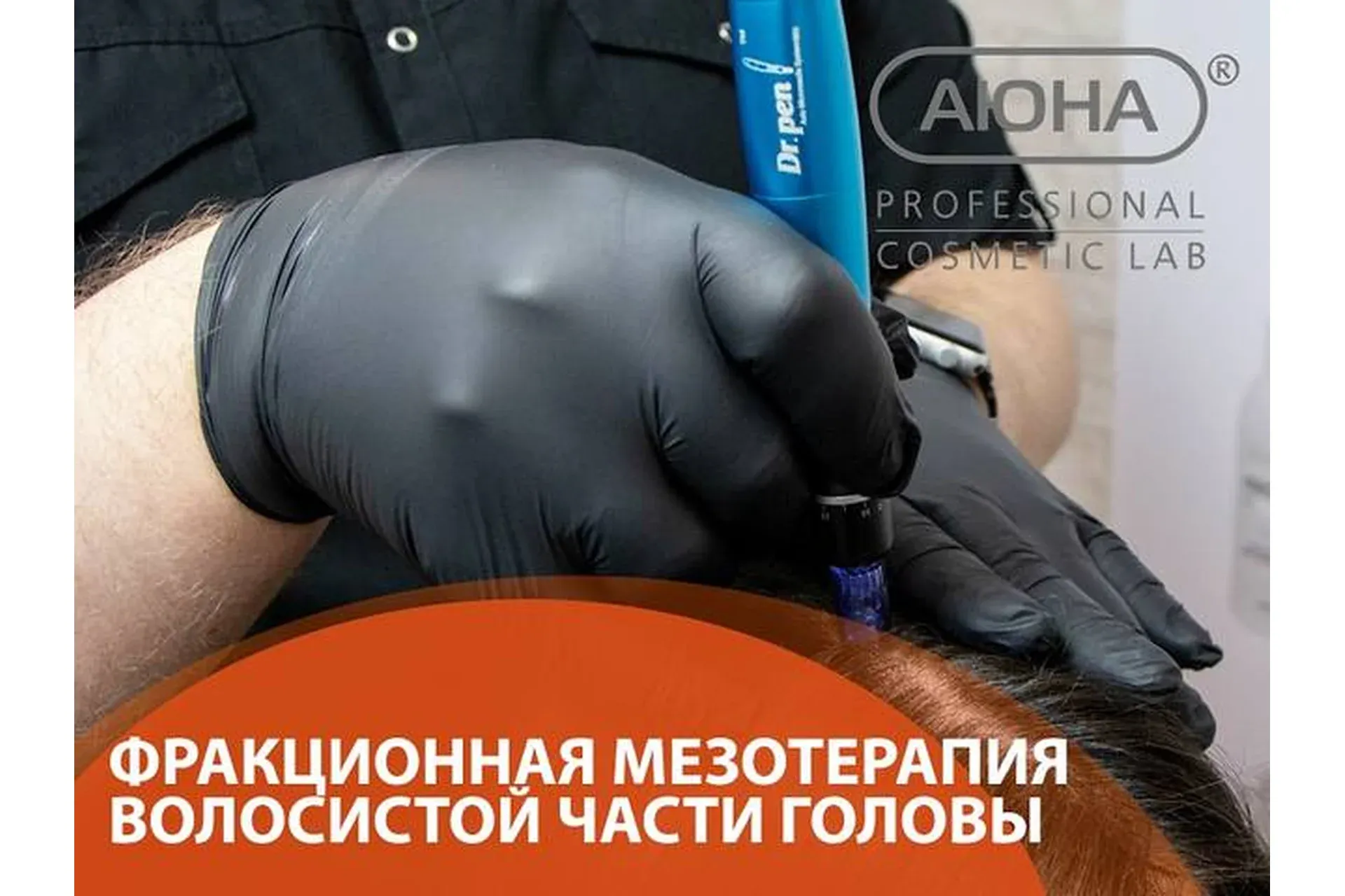 [Аюна] Фракционная мезотерапия волосистой части головы (Романис Ботин–Маевски)